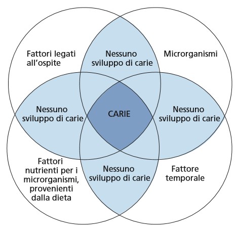 Perché si cariano i denti