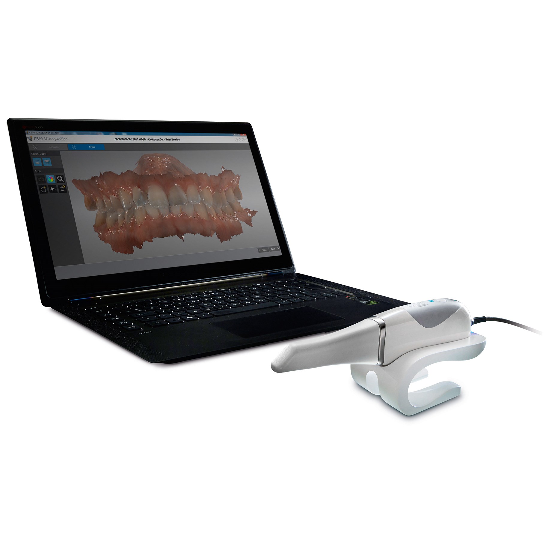 Scanner intraorale digitale con visualizzazione tridimensionale dei denti